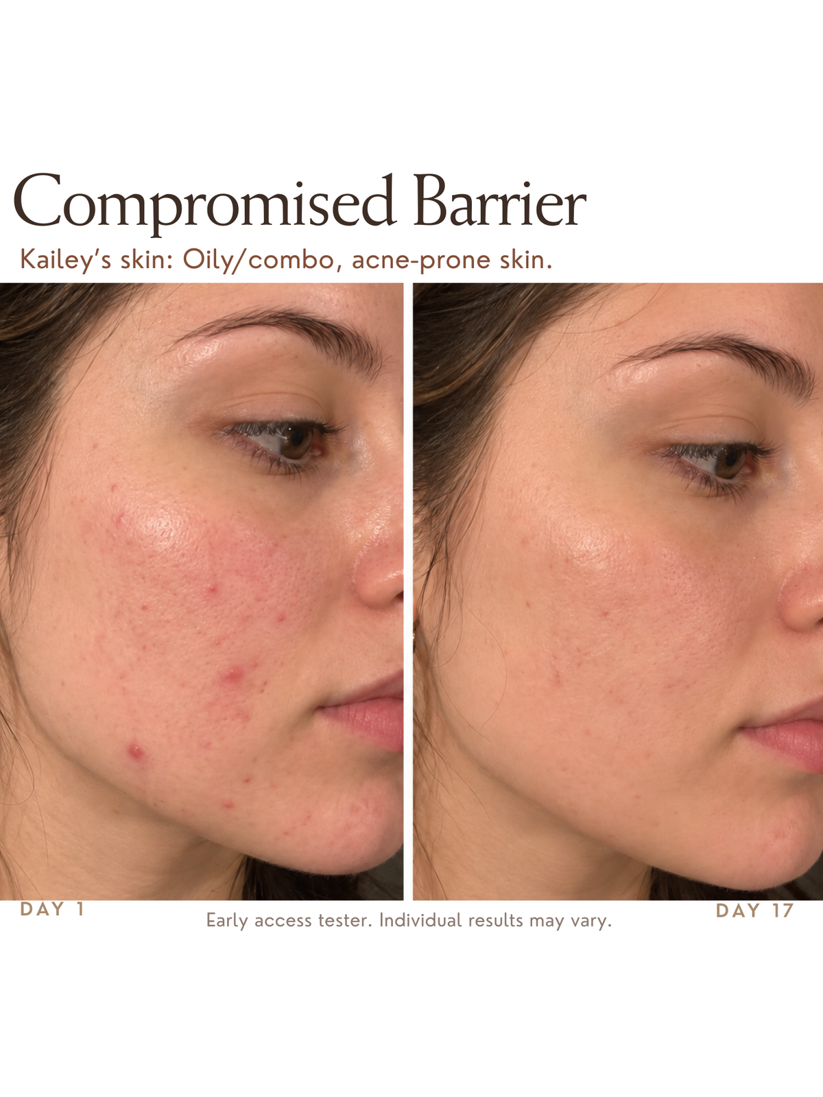 Barrier Moisturizer for Oily & Combo Skin