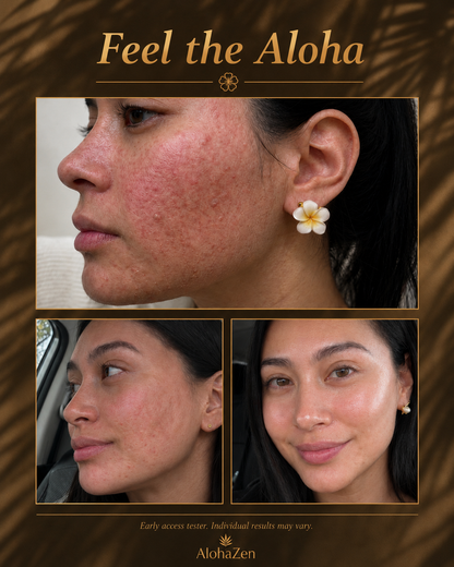 Weightless Barrier Support Moisturizer